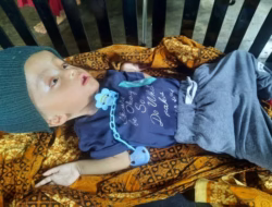 Bayi Hidrosefalus di Tapsel Butuh Uluran Tangan untuk Perawatan di Medan