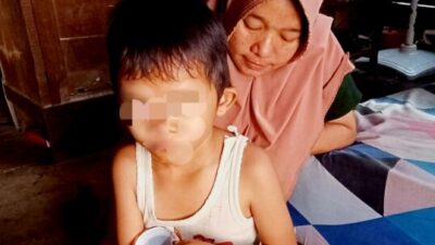 Rahmad, Bocah Disabilitas Asal Hutapuli Butuh Uluran Tangan Dermawan